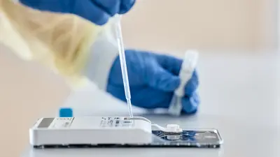 A sample is placed in the Vivalytic test cartridge.